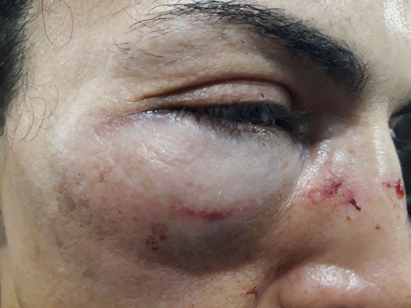 Οι εικόνες και τα βίντεο από το αιματοβαμμένο δημοψήφισμα στην Καταλονία, που σόκαραν τον πλανήτη -Ξύλο, πλαστικές σφαίρες, βία | iefimerida.gr 3