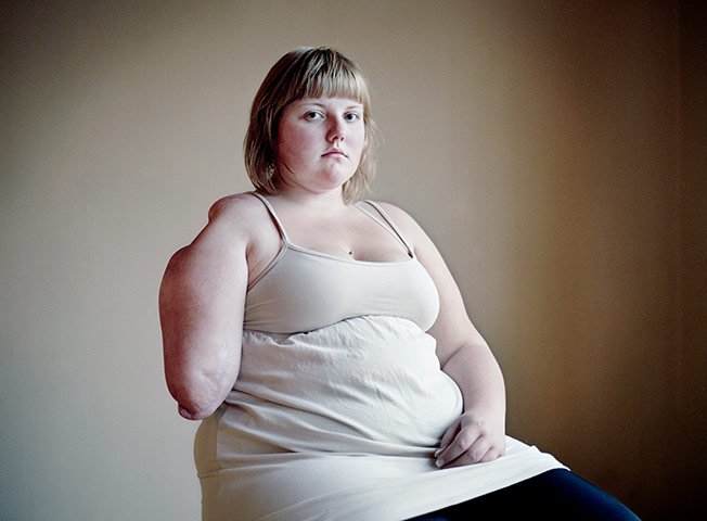 Τα συγκλονιστικά πορτραίτα των νέων που γλίτωσαν από τη φονική μανία του Μπρέιβικ βραβεύθηκαν σε διαγωνισμό [εικόνες] | iefimerida.gr 2