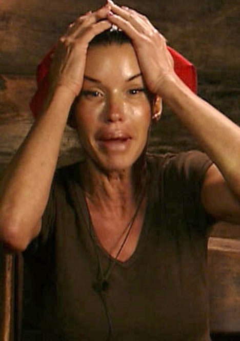  Το σουπερμόντελ που φαλίρισε εξαιτίας των πολλών πλαστικών [εικόνες]  | iefimerida.gr 0