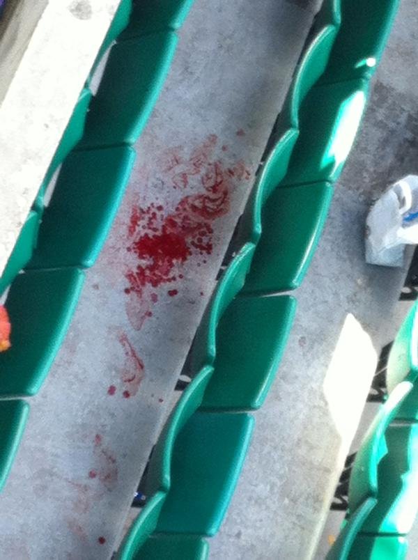 Ατύχημα στο Ρολάν Γκαρός: Μεταλλική πινακίδα έπεσε στα κεφάλια θεατών [εικόνες & βίντεο] | iefimerida.gr 4