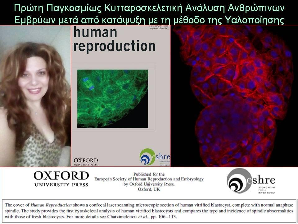 Ελληνίδα γενετίστρια ανέλυσε ανθρώπινα έμβρυα μετά από κατάψυξη [εικόνες] | iefimerida.gr 0