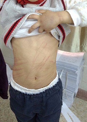 Βασανιστήρια στην Κίνα: Μαστίγωσε τον θετό της γιο γιατί δεν ήξερε το παραμύθι του Πινόκιο [εικόνες] | iefimerida.gr 0