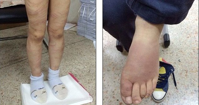 Βασανιστήρια στην Κίνα: Μαστίγωσε τον θετό της γιο γιατί δεν ήξερε το παραμύθι του Πινόκιο [εικόνες] | iefimerida.gr 2