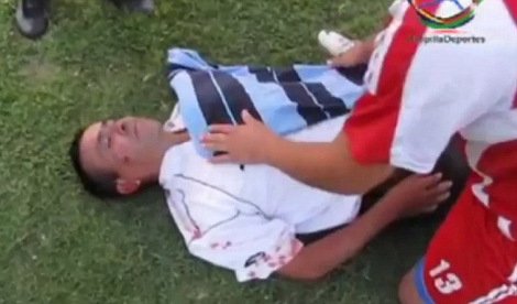 Απίστευτο ξύλο σε ερασιτεχνικό πρωτάθλημα ποδοσφαίρου στη Χιλή [εικόνες & βίντεο] | iefimerida.gr 1