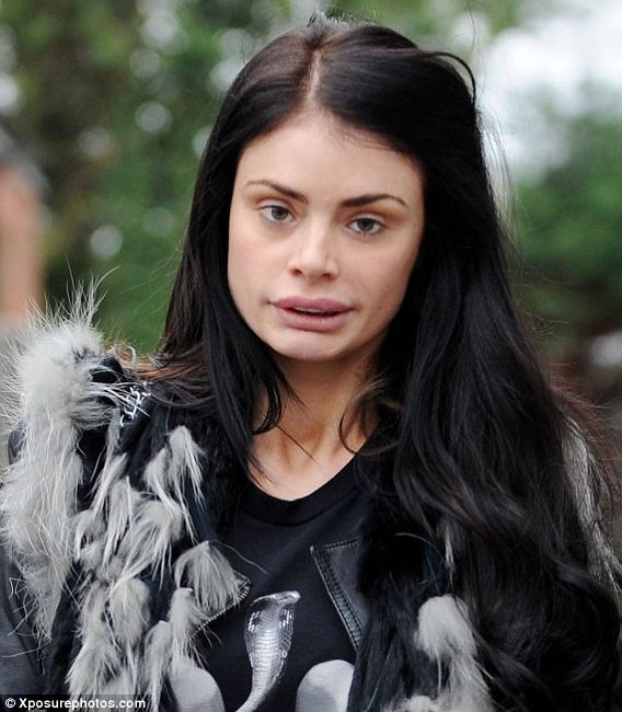 H γυναίκα που ξόδεψε 46.000 ευρώ για να κάνει τα δόντια της από πορσελάνη [εικόνες] | iefimerida.gr 16