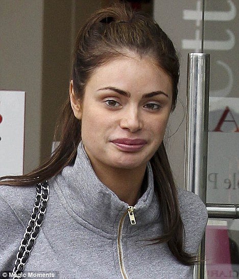 H γυναίκα που ξόδεψε 46.000 ευρώ για να κάνει τα δόντια της από πορσελάνη [εικόνες] | iefimerida.gr 17