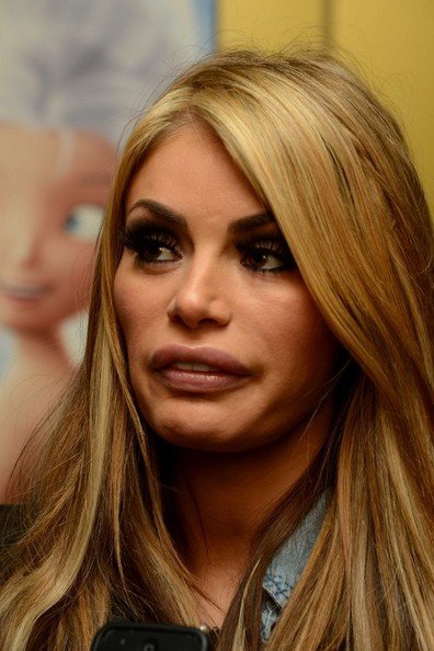 H γυναίκα που ξόδεψε 46.000 ευρώ για να κάνει τα δόντια της από πορσελάνη [εικόνες] | iefimerida.gr 12