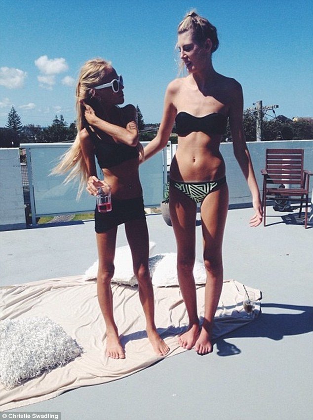 18χρονη έφτασε τα 30 κιλά [εικόνες] | iefimerida.gr 1