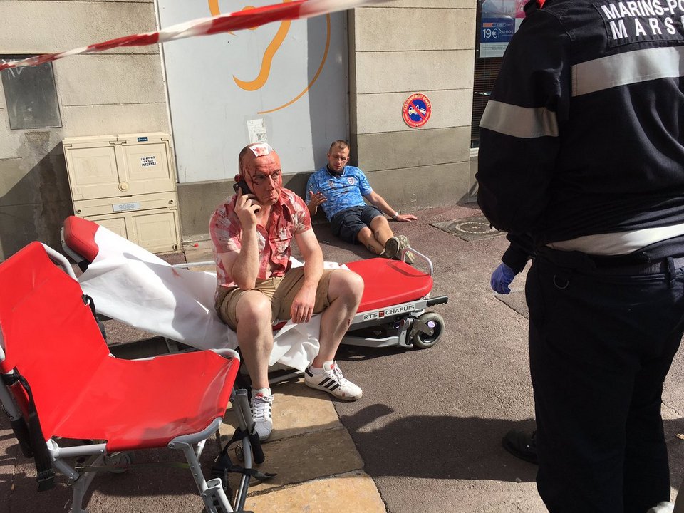 Χαροπαλεύει Αγγλος οπαδός [εικόνες & βίντεο] | iefimerida.gr 2