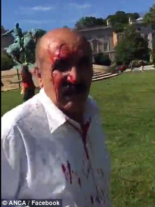 Αγρια επίθεση από σωματοφύλακες του Ερντογάν κατά Κούρδων διαδηλωτών– 9 τραυματίες [εικόνες & βίντεο]  | iefimerida.gr 1