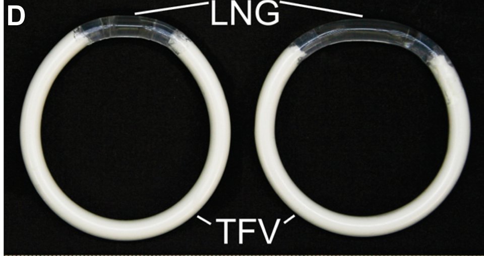  Ιατρικό θαύμα- Το νέο δαχτυλίδι, που μειώνει τον κίνδυνο του Aids στις γυναίκες [εικόνες] | iefimerida.gr 3