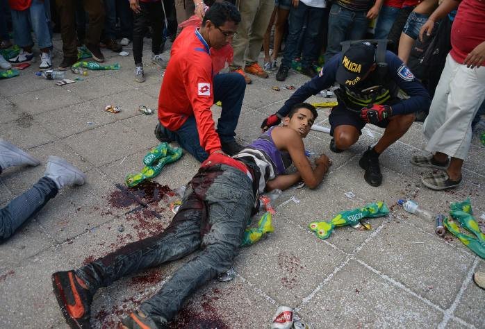 Αίμα και δάκρυα στην Κόστα Ρίκα -Μαχαίρωσαν τρεις φιλάθλους μετά από τον αποκλεισμό από το Μουντιάλ [εικόνες] | iefimerida.gr 7