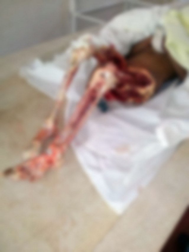 Φρίκη για 6χρονη στον Αμαζόνιο: Την κατασπάραξαν ζωντανή τα πιράνχας [εικόνες] | iefimerida.gr 2