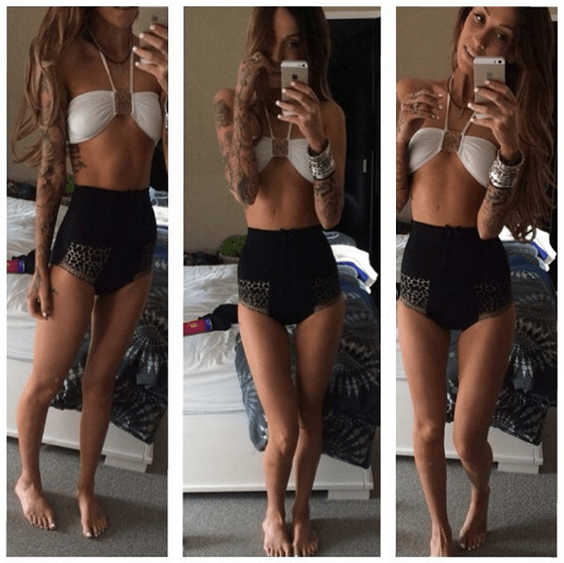 Mοντέλο φωτογραφίζεται με τη νόσο του Κρον και συγκλονίζει το facebook [εικόνες] | iefimerida.gr 1