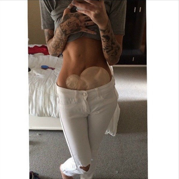 Mοντέλο φωτογραφίζεται με τη νόσο του Κρον και συγκλονίζει το facebook [εικόνες] | iefimerida.gr 9