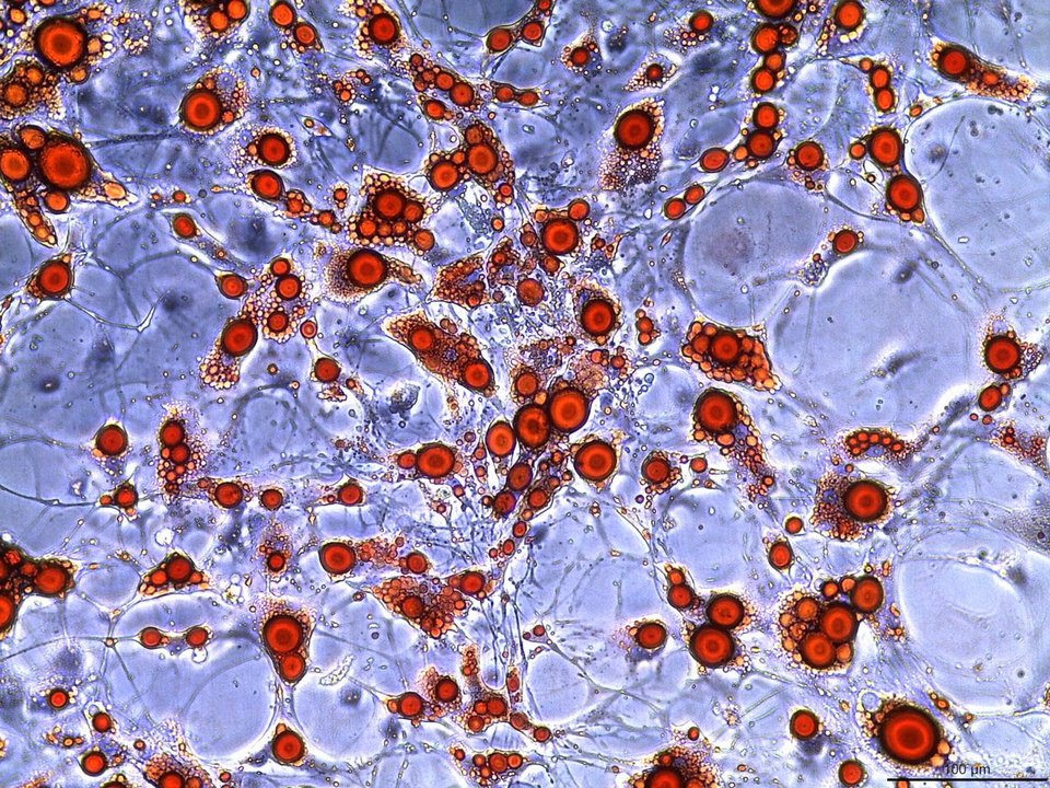 Ενας άγνωστος κόσμος: Οι καλύτερες φωτογραφίες μικροσκοπίου για το 2016 [εικόνες] | iefimerida.gr 10