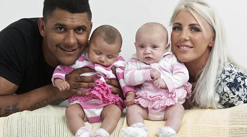 Μια στο εκατομμύριο – Γεννήθηκαν δίδυμα κοριτσάκια με διαφορετικό χρώμα [εικόνες]  | iefimerida.gr 0