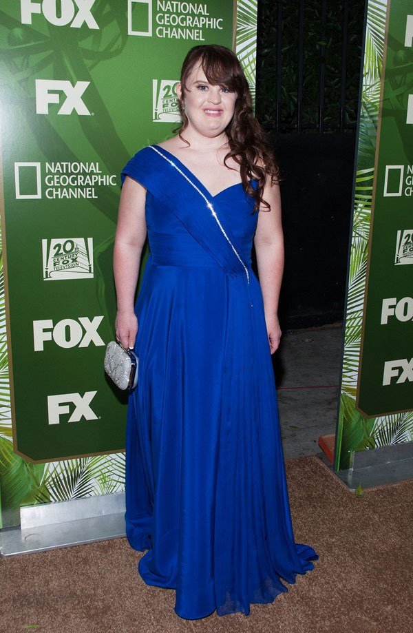 H πρώτη γυναίκα με σύνδρομο Down που θα κάνει πασαρέλα στην Νέα Υόρκη [εικόνες]  | iefimerida.gr 2