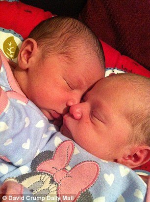 Μια στο εκατομμύριο – Γεννήθηκαν δίδυμα κοριτσάκια με διαφορετικό χρώμα [εικόνες]  | iefimerida.gr 1