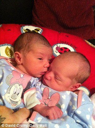 Μια στο εκατομμύριο – Γεννήθηκαν δίδυμα κοριτσάκια με διαφορετικό χρώμα [εικόνες]  | iefimerida.gr 2