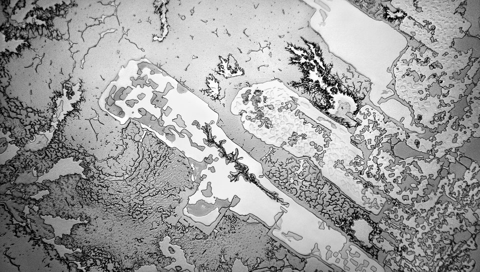 Ετσι είναι τα δάκρυα από το μικροσκόπιο -Φωτογράφος μετατρέπει τον πόνο σε τέχνη [εικόνες] | iefimerida.gr 5