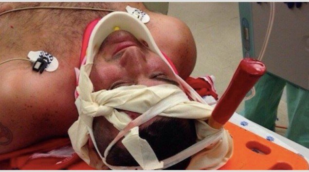 Σοκ στο Ισραήλ: Επιτέθηκαν σε οπαδό και του κάρφωσαν τσεκούρι στο κεφάλι [εικόνες] | iefimerida.gr 0