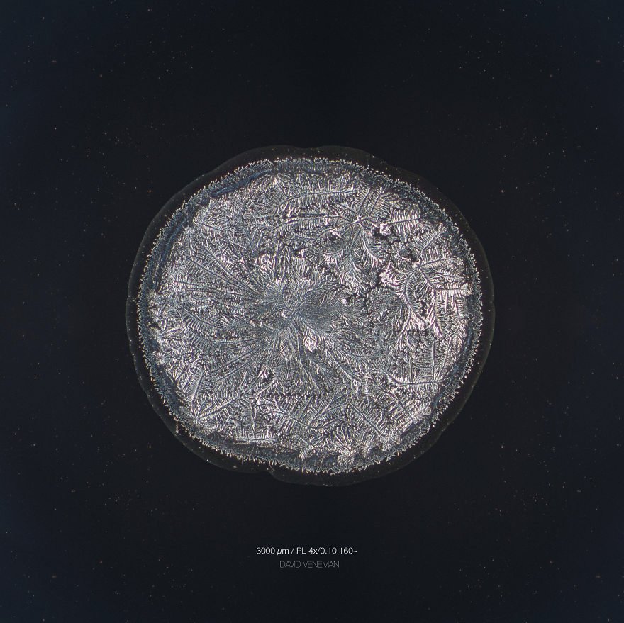 Ο μαγικός κόσμος των δακρύων κάτω από το μικροσκόπιο -Γιατί το κάθε δάκρυ είναι μοναδικό [εικόνες] | iefimerida.gr 3