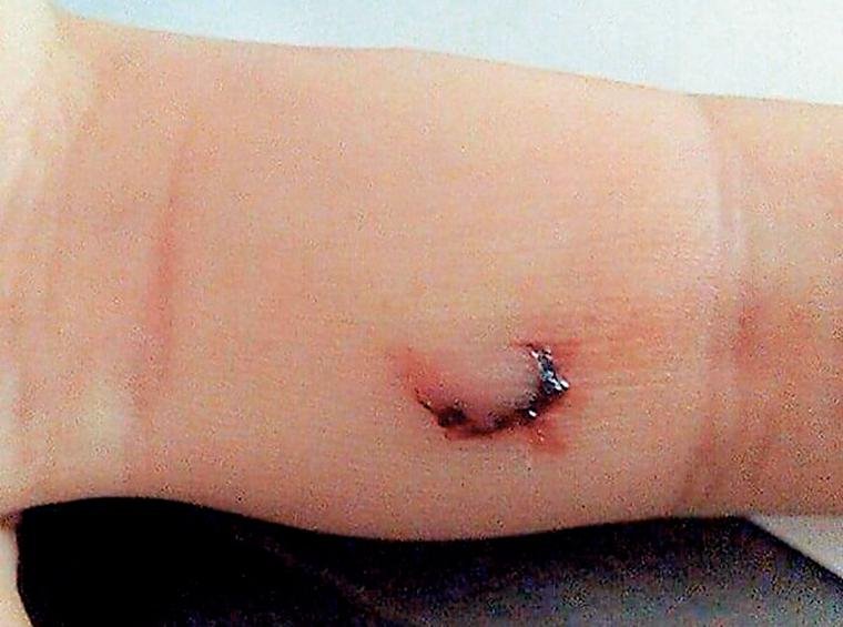 Πιράνχας δάγκωσε ψαρά στη λίμνη Δοϊράνη [εικόνα] | iefimerida.gr 0