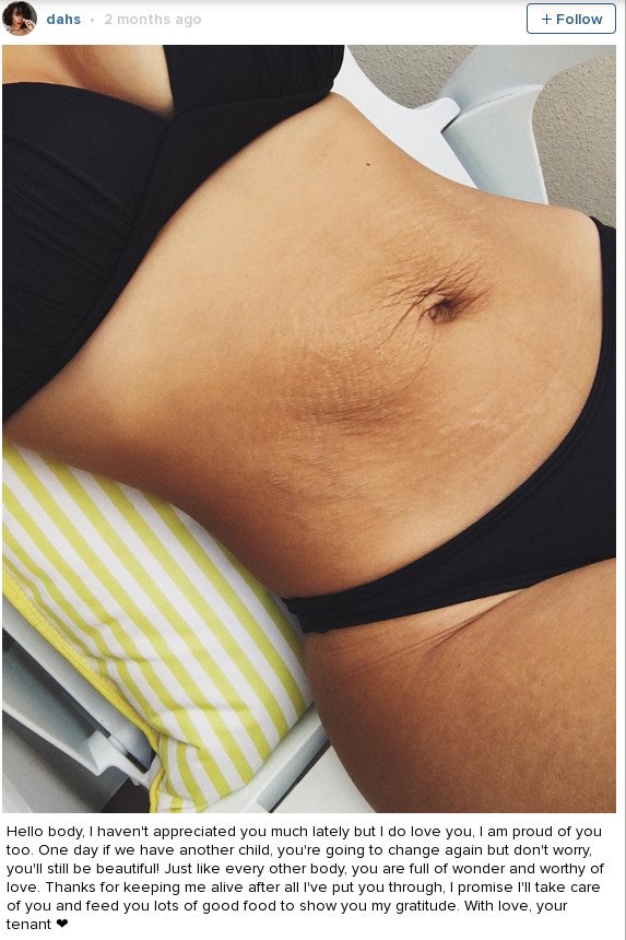 Νέα μαμά «την λέει» στις τέλειες γυναίκες: Ετσι είναι το σώμα μετά τη γέννα -Με σημάδια [εικόνες] | iefimerida.gr 4