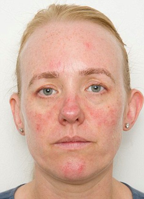 Πείραμα με αποτελέσματα σοκ: Το πριν και το μετά του προσώπου μιας γυναίκας που δεν ξεβαφόταν τα βράδια επί ένα μήνα [εικόνες] | iefimerida.gr 1