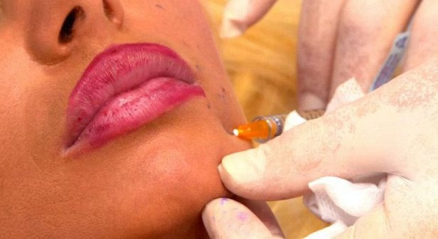 Το πιο διάσημο μοντέλο του Ισραήλ: Μια κακόγουστη απομίμηση της Barbie που λατρεύει τις πλαστικές [εικόνες&βίντεο] | iefimerida.gr 1