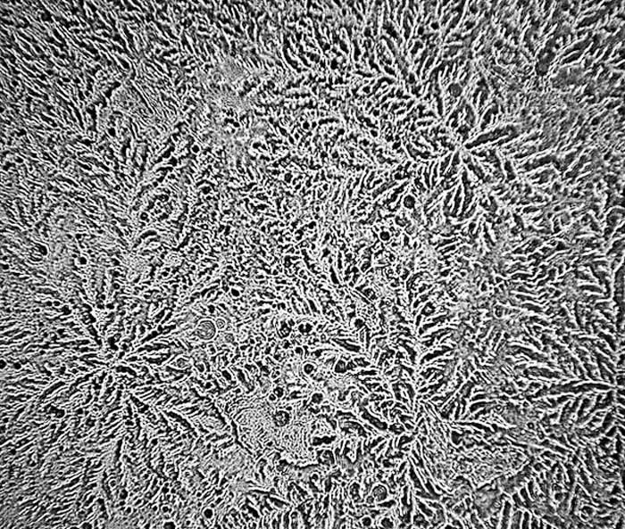 Τα δάκρυα στο μικροσκόπιο: Δεν φαντάζεστε πώς είναι το υγρό που τρέχει από τα μάτια μας [εικόνες] | iefimerida.gr 1