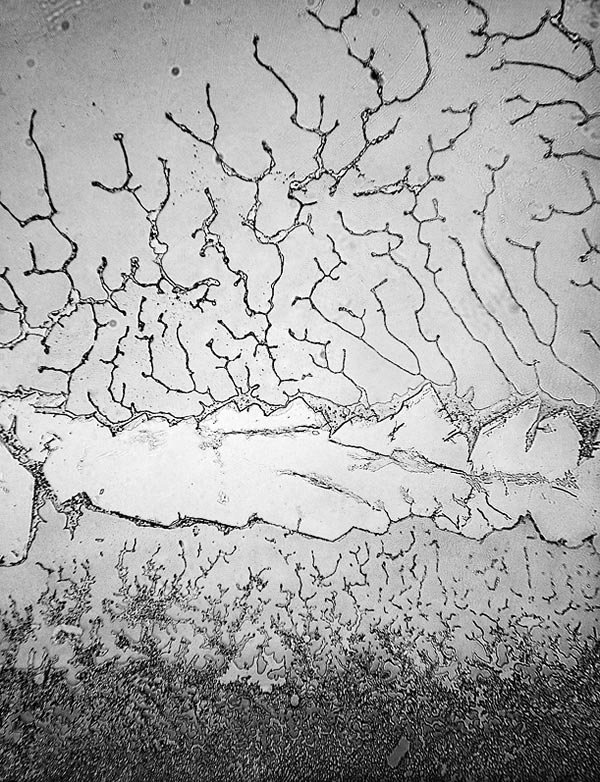 Τα δάκρυα στο μικροσκόπιο: Δεν φαντάζεστε πώς είναι το υγρό που τρέχει από τα μάτια μας [εικόνες] | iefimerida.gr 5