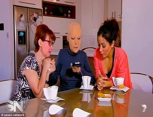 H γυναίκα με τη μάσκα αποκάλυψε το πρόσωπό της -Τη φορούσε 2,5 χρόνια, είχε φριχτά εγκαύματα μετά από επίθεση [εικόνες] | iefimerida.gr 7