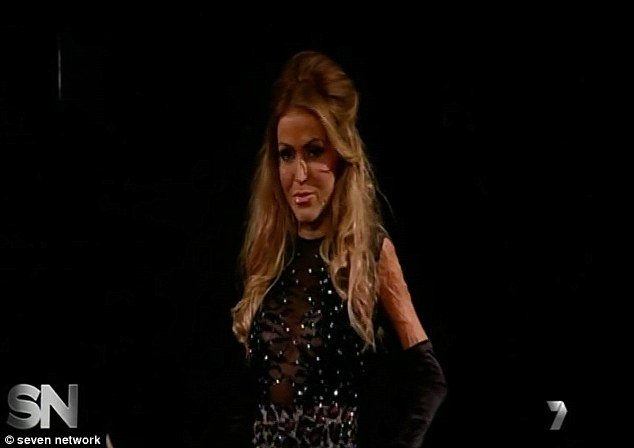 H γυναίκα με τη μάσκα αποκάλυψε το πρόσωπό της -Τη φορούσε 2,5 χρόνια, είχε φριχτά εγκαύματα μετά από επίθεση [εικόνες] | iefimerida.gr 4