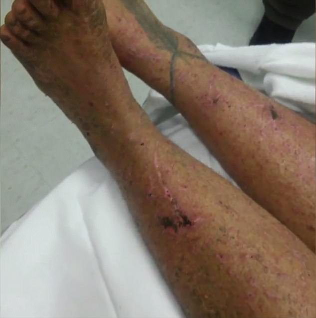 Εζησε την απόλυτη περιπέτεια επιβίωσης -Χάθηκε σε αχανές δάσος, έτρωγε μούρα και κατάφερε να ζήσει [εικόνες & βίντεο] | iefimerida.gr 1