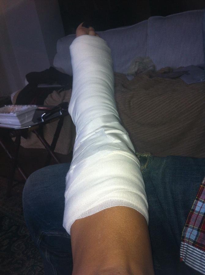 Έσπασε το πόδι της η Φαίη Σκορδά [εικόνα+ βίντεο]  | iefimerida.gr 0