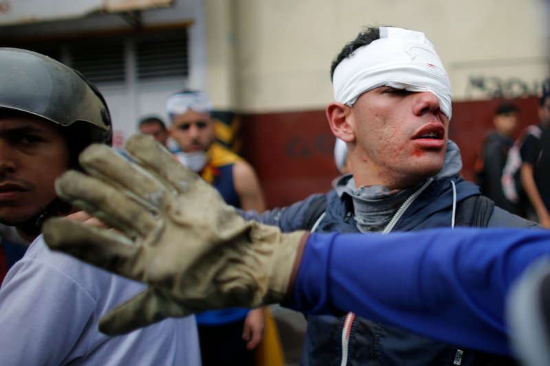 Βενεζουέλα: 17χρονος νεκρός από σφαίρα στο στήθος σε διαδήλωση κατά του Μαδούρο [εικόνες] | iefimerida.gr 5