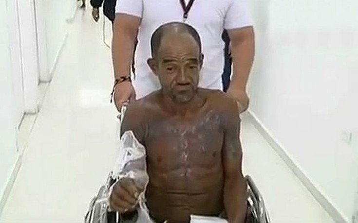 Ο άνθρωπος που ξεγέλασε τον θάνατο – Τον «χτύπησαν» 13.000 βολτ και σώθηκε [εικόνες]  | iefimerida.gr 0