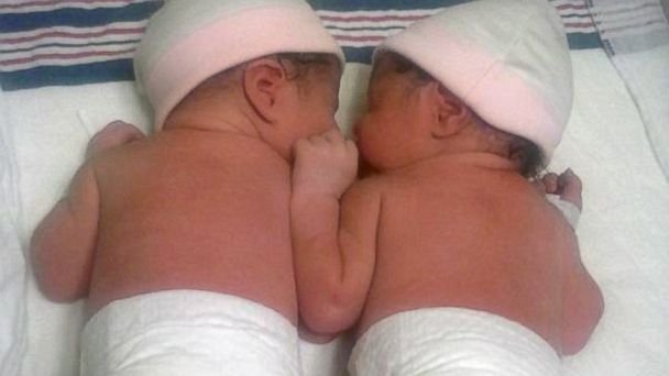 Γεννήθηκαν δίδυμα με διαφορά... ενός χρόνου -Το παιχνίδι με τα δευτερόλεπτα και το θαύμα της φύσης [εικόνες] | iefimerida.gr 1