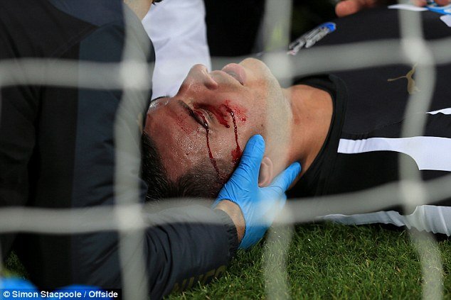 Τρομακτικός τραυματισμός ποδοσφαιριστή στο δοκάρι -Αντεξε και συνέχισε τον αγώνα [εικόνες] | iefimerida.gr 0