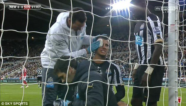 Τρομακτικός τραυματισμός ποδοσφαιριστή στο δοκάρι -Αντεξε και συνέχισε τον αγώνα [εικόνες] | iefimerida.gr 3