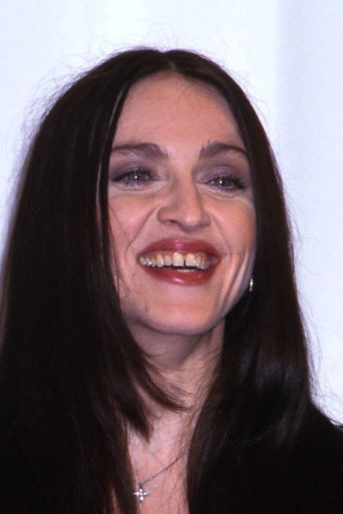 Διάσημοι σταρ πριν και μετά τον οδοντίατρο [εικόνες] | iefimerida.gr 0