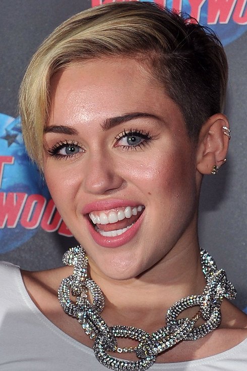 Διάσημοι σταρ πριν και μετά τον οδοντίατρο [εικόνες] | iefimerida.gr 7