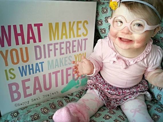 Η κόρη μου έχει σύνδρομο Down -Η μπλόγκερ που θέλει ο κόσμος να μάθει την ομορφιά πίσω από τη διαφορετικότητα [εικόνες] | iefimerida.gr 3