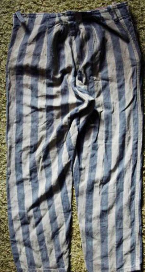 Αποτροπιασμός στο eBay: Πουλούσαν για χιλιάδες ευρώ μακάβρια κειμήλια από τους νεκρούς του Αουσβιτς [εικόνες] | iefimerida.gr 1