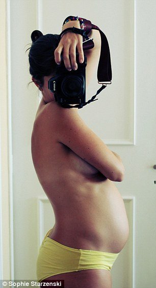 Aπό τη σύλληψη ως τη γέννα σε 10 φωτογραφίες [εικόνες] | iefimerida.gr 3