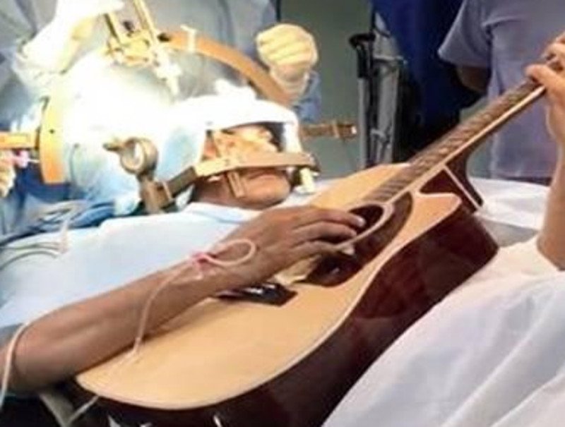 Aπίστευτο: Μουσικός στην Ινδία χειρουργείται στο κεφάλι και... παίζει κιθάρα! [εικόνα]  | iefimerida.gr 0