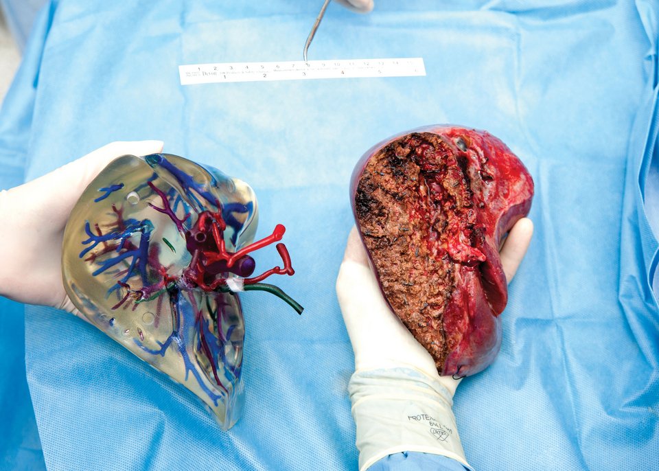 Η χειρουργική κλινική του ΑΠΘ πέτυχε την τρισδιάστατη μοντελοποίηση ανθρώπινων οργάνων [εικόνες] | iefimerida.gr 0