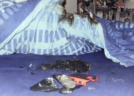 Στο νοσοκομείο 11χρονος με εγκαύματα μετά από έκρηξη BlackBerry κινητού [εικόνες] | iefimerida.gr 0